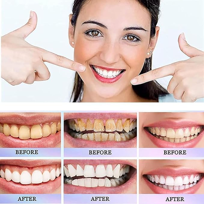 Oralhoe Nicotinamide Dazzle White Toothpaste – 100g